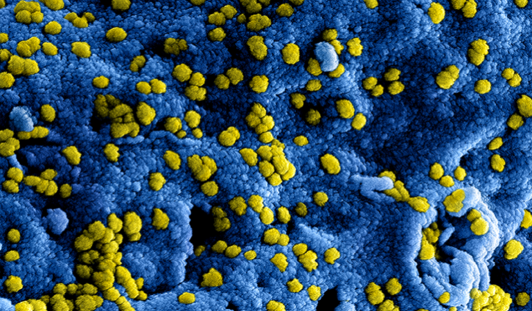 Duits onderzoek: Coronavirus niet overdraagbaar via voorwerpen